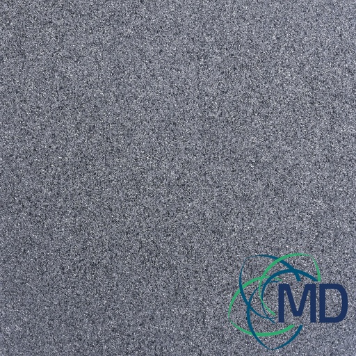 [299003] 299003